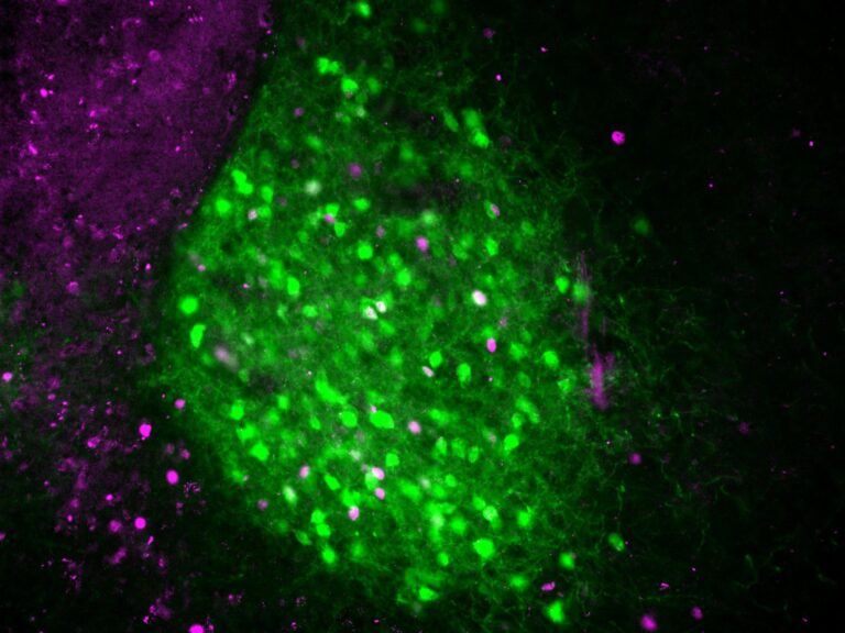 Las neuronas IPACL CRF (verdes) se activan cuando los ratones se encuentran con nuevos entornos y liberan neurotensina para mantener el estado de alerta. Este circuito cerebral podría explicar el 'efecto de la primera noche' en los seres humanos. Crédito: Hung et al., 2026/Nagoya University